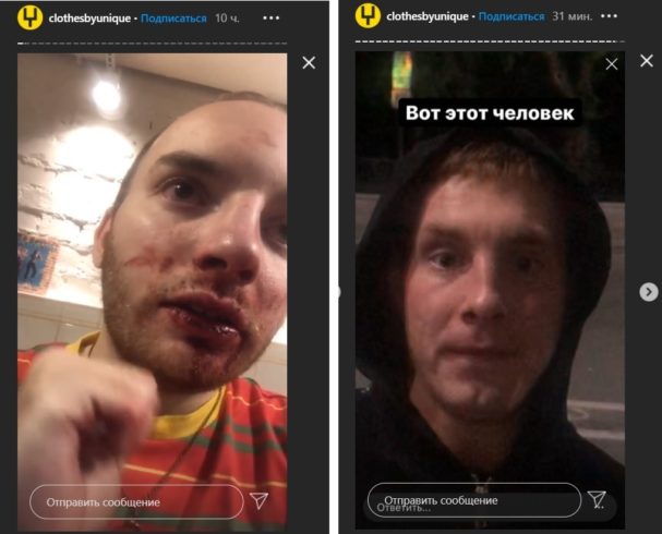 Потерпевший Андрей Аллегров после инцидента (слева) и нападавший Павел Зуев (справа). Скриншот из сториз UNIQUE