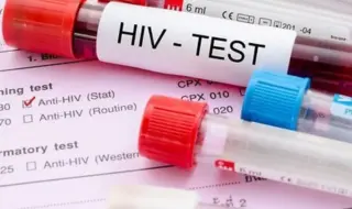 На изображении склянка с кровью и подпись ВИЧ тест (HIV test)