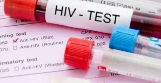 На изображении склянка с кровью и подпись ВИЧ тест (HIV test)